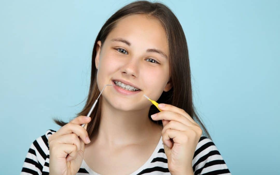 How to Care for Your Braces