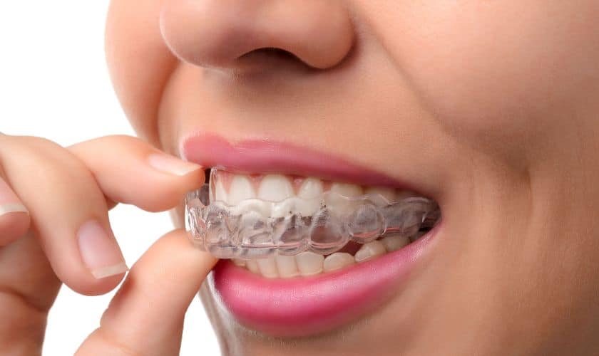 Do Invisalign Retainers Cause Problems To The Gums?