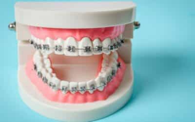 Know The 5 Major Benefits Of Orthodontics