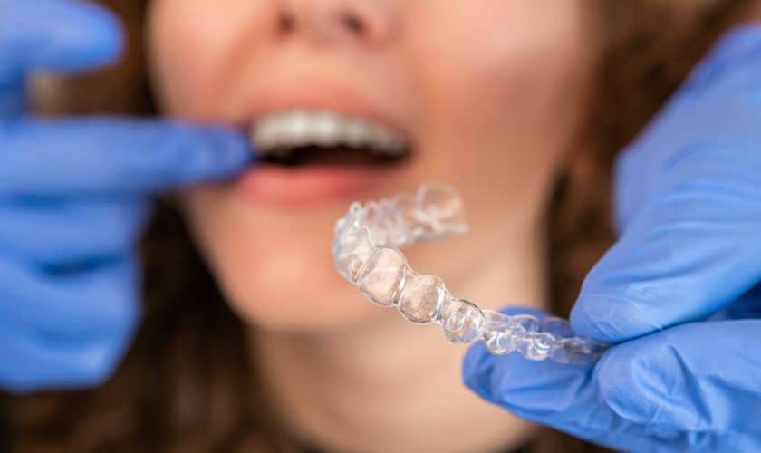 Confidence in Clear Aligners: A Teen’s Guide to Invisalign Success