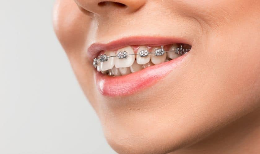 Orthodonist in Homewood IL