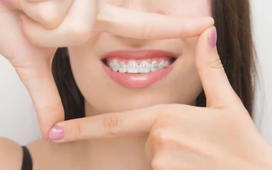 Orthodontist for Braces
