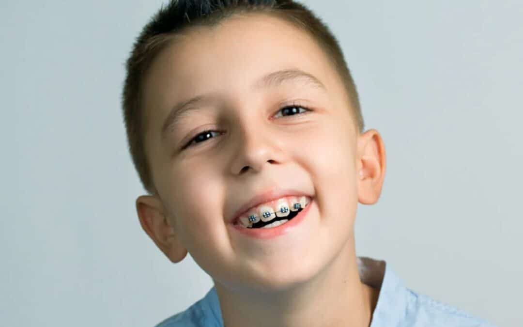 Can Early Orthodontics Prevent Speech Impediments?