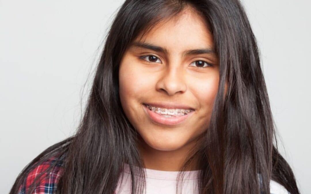 5 Common Mistakes to Avoid with Ceramic Braces