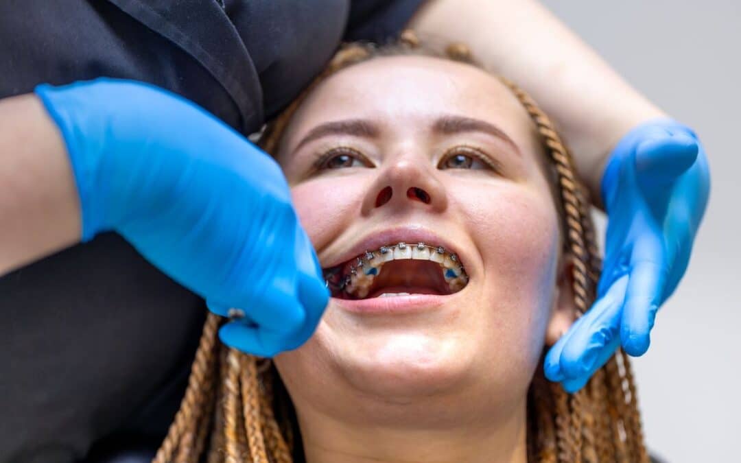 Does Age Affect Adult Orthodontics?