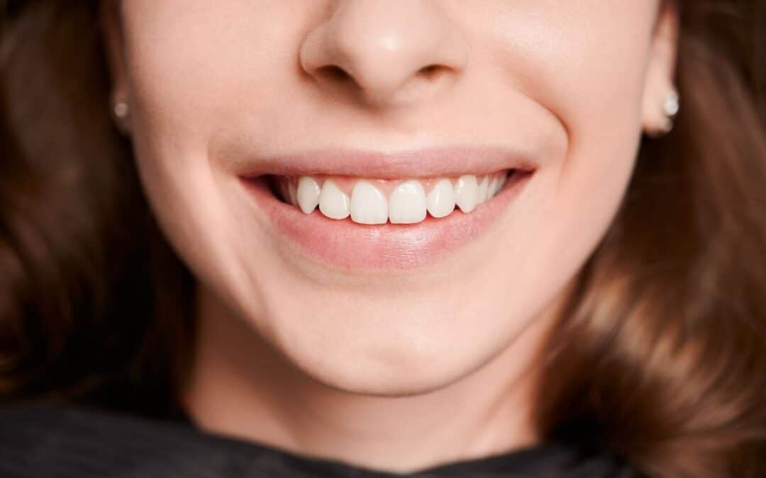 Are there age restrictions for teeth whitening treatments?