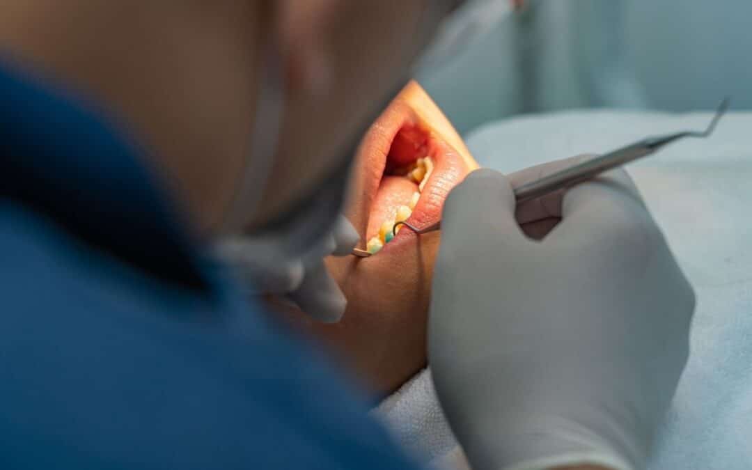 How often do adults need checkups during orthodontic treatment?