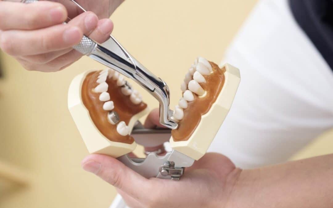 How often should you schedule professional teeth whitening?