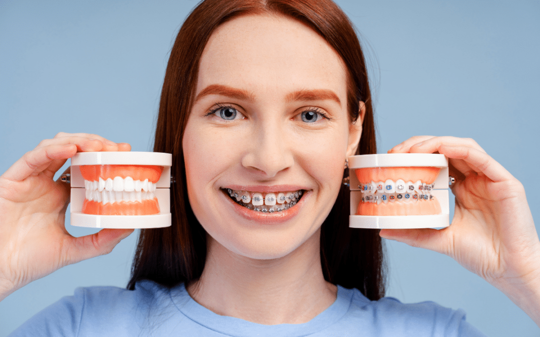 Braces vs. Invisalign