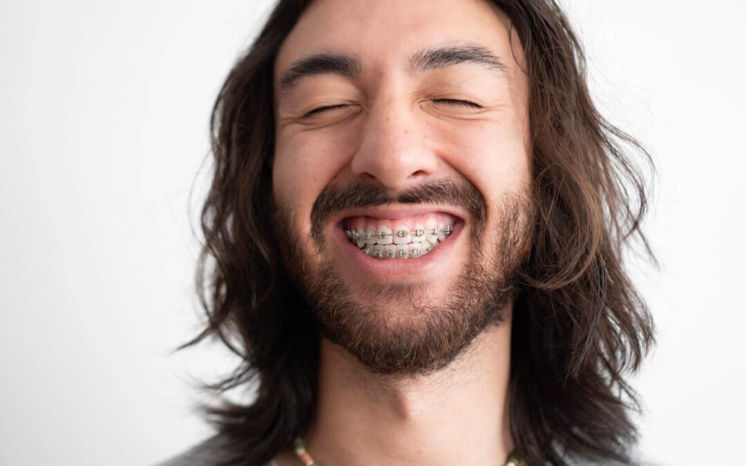 Adult Braces Results in Homewood, IL