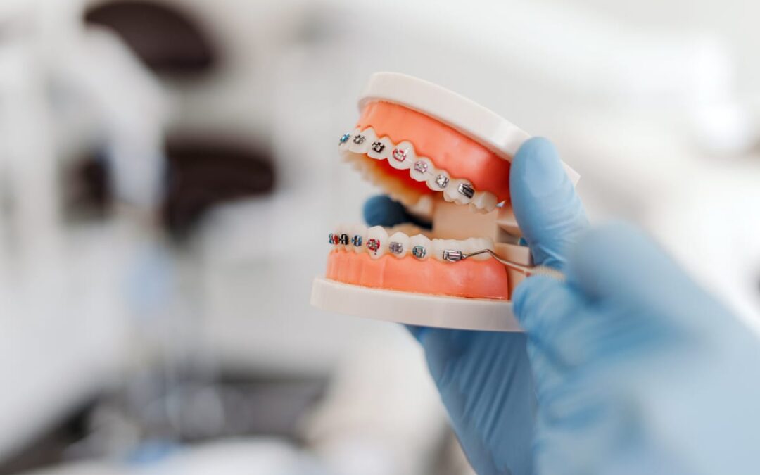What Happens During Your First Orthodontic Appointment